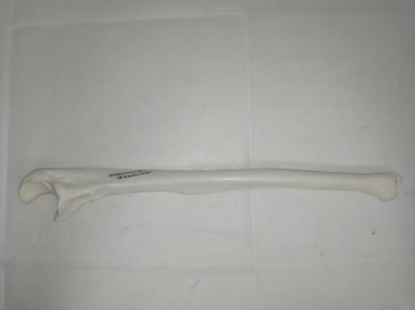 Ulna